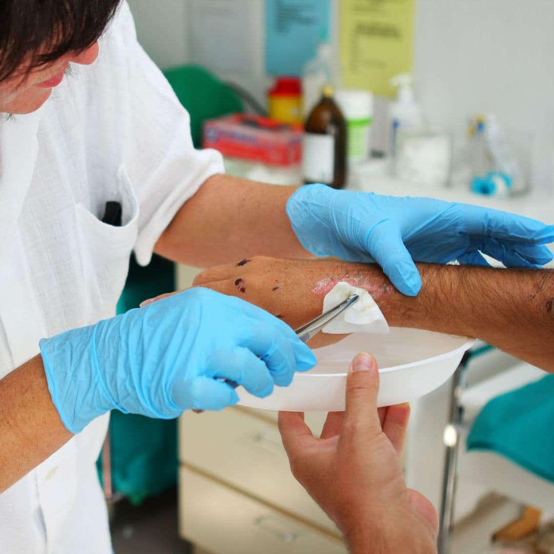 Complex wound care support
