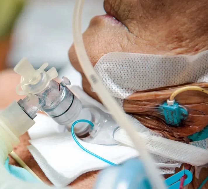 Tracheostomy care support